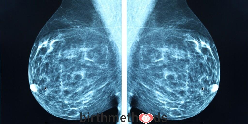 How do I prepare for a breast cancer screening