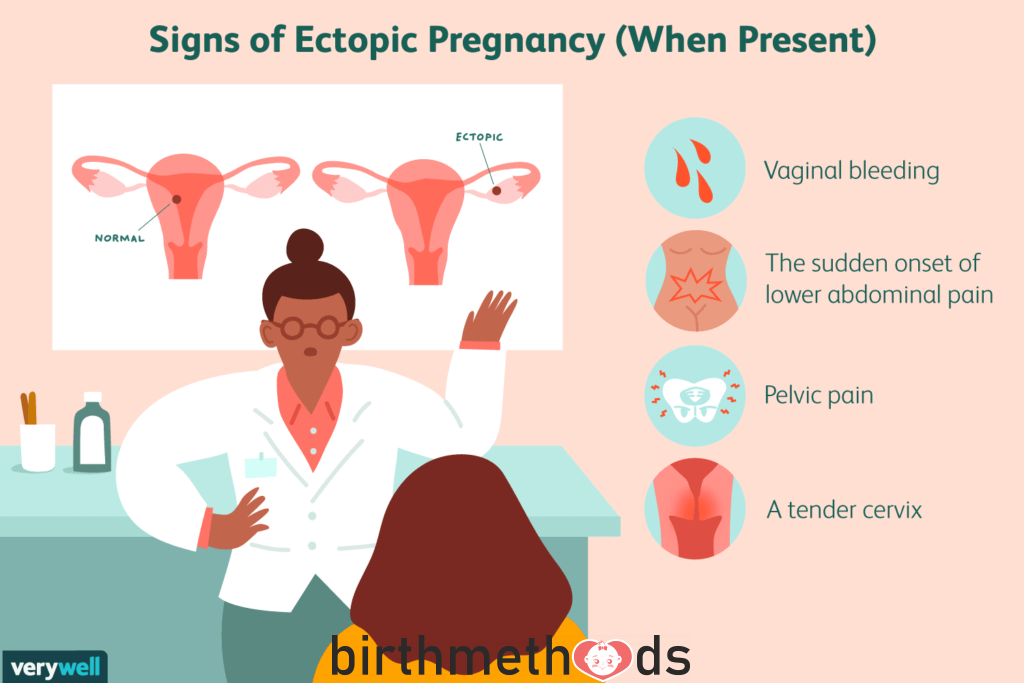 What are the 3 causes of an ectopic pregnancy